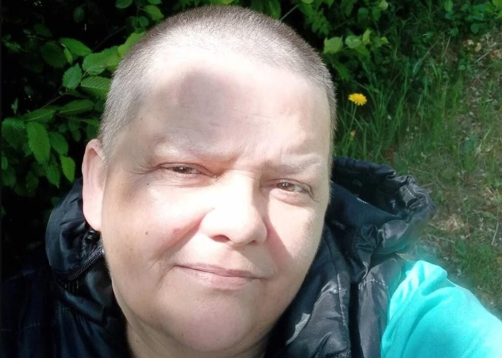 Arnela se sedam godina bori sa opakom bolešću: Pomozimo joj da se bol pretvori u osmijeh